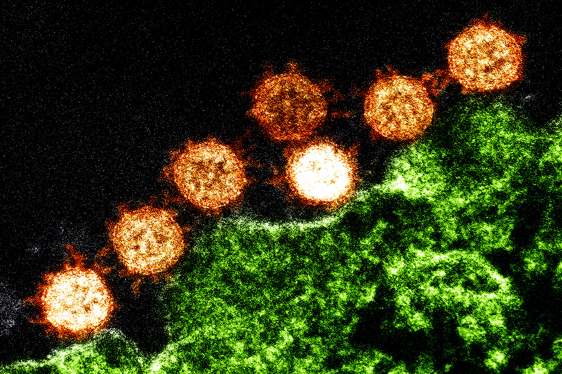 Symptômes et diagnostic du coronavirus de Chine : ce qu’il faut savoir